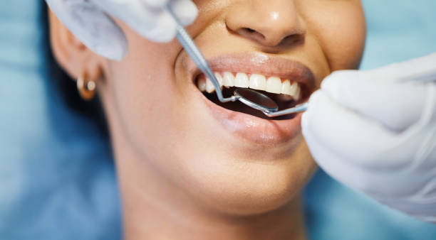 Best Pediatric Emergency Dentist in Sequim, WA